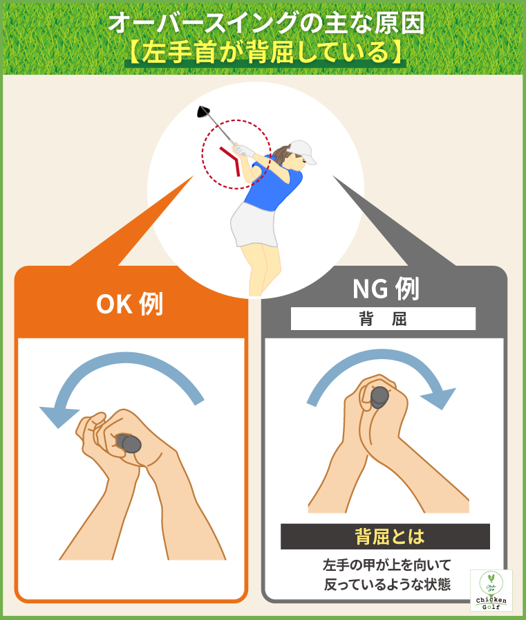 左手首が背屈している