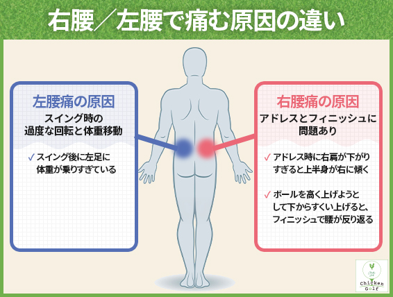右側・左側で腰が痛む理由が違う理由
