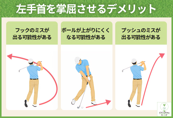 左手首を掌屈させるデメリット