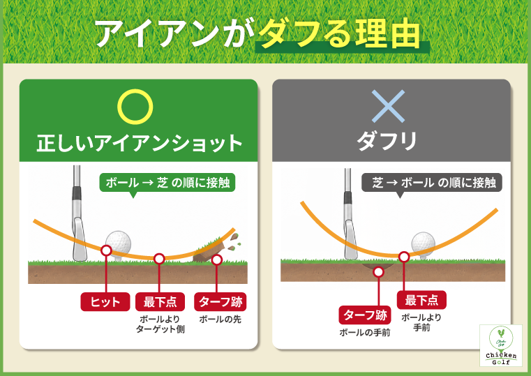 アイアンでダフる理由